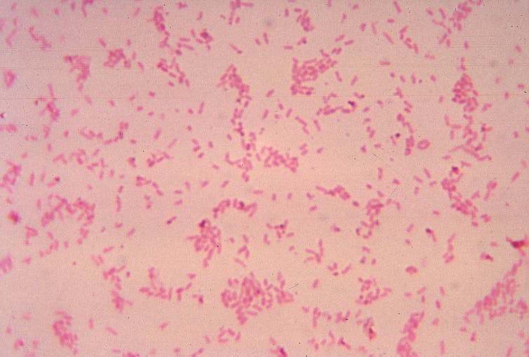 A micrograph of B fragilis.