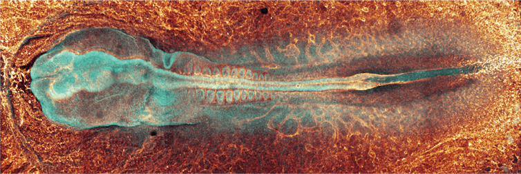 An embryo coloured in fluorescent blue and orange.