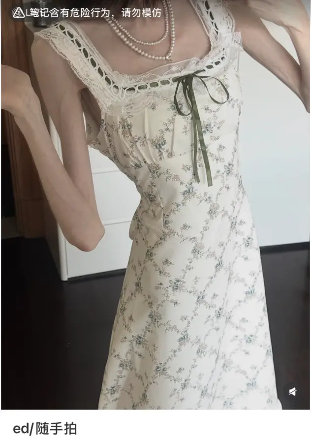 An image of a person with a very thin body wearing a dress, with a warning label at the top indicating risky behavior.