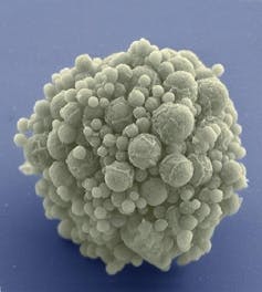 Microscopy image of a grey spherical blob with a rough surface of spherical protuberances