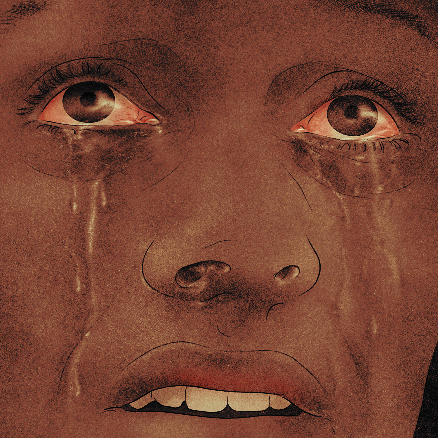 A close-up illustration of a person’s face. Their eyes are red and tears are streaming down their cheeks.