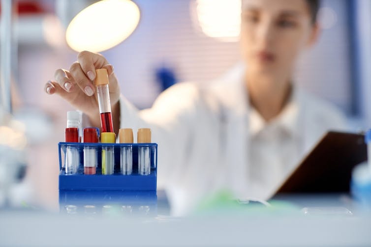 Blood samples on a blue rack. A person in a white coat holds one.