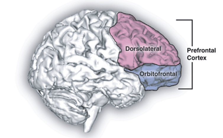 A drawing of the brain, with the two parts of the prefrontal cortex — dorsolateral and orbitofrontal — shaded in pink and blue on the right side of the image.
