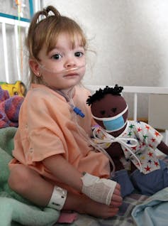 Child with nasal cannula sitting on bed, holding a doll wearing a surgical mask